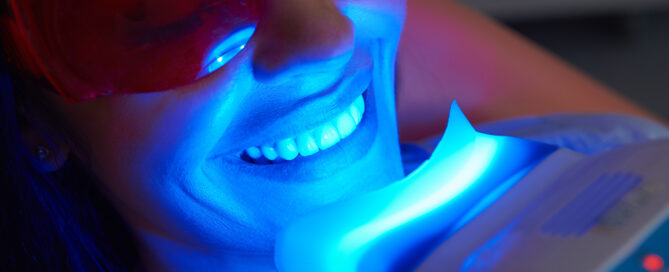 Brighten Your Smile: Professional vs At-Home Whitening
