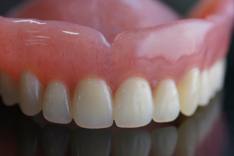 Upper dentures for replacing missing upper teeth at Noel Dental Arts